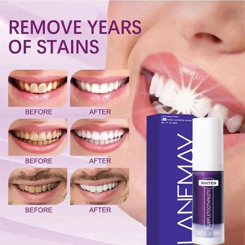 Bright Smile Saver Mousse Toothpaste